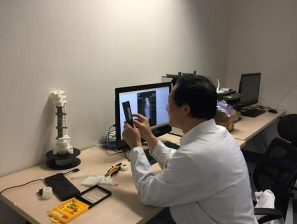 3D打印醫療應用成功案例 北醫三院3D打印定制人工椎體植入術