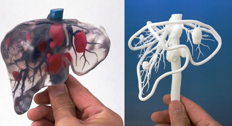 簡述現(xiàn)階段醫(yī)用3D打印設(shè)備和打印材料的相關(guān)進(jìn)展_e鍵3D打印服務(wù) 簡述現(xiàn)階段醫(yī)用3D打印設(shè)備和打印材料的相關(guān)進(jìn)展_e鍵3D打印服務(wù)