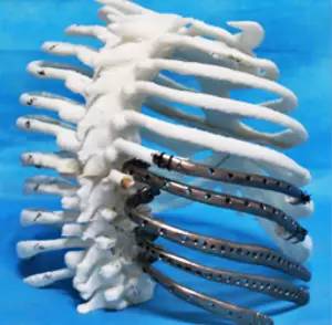 第四軍醫大學精彩分享個性化醫療3D打印的實戰案例與研究成果