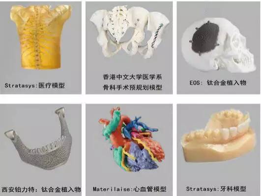3d打印在醫療領域的應用 3D打印與醫療行業白皮書 3d打印在醫療領域的應用 3D打印與醫療行業白皮書