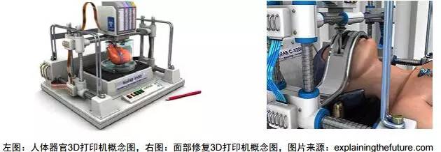 3d打印在醫療領域的應用 3D打印與醫療行業白皮書 3d打印在醫療領域的應用 3D打印與醫療行業白皮書