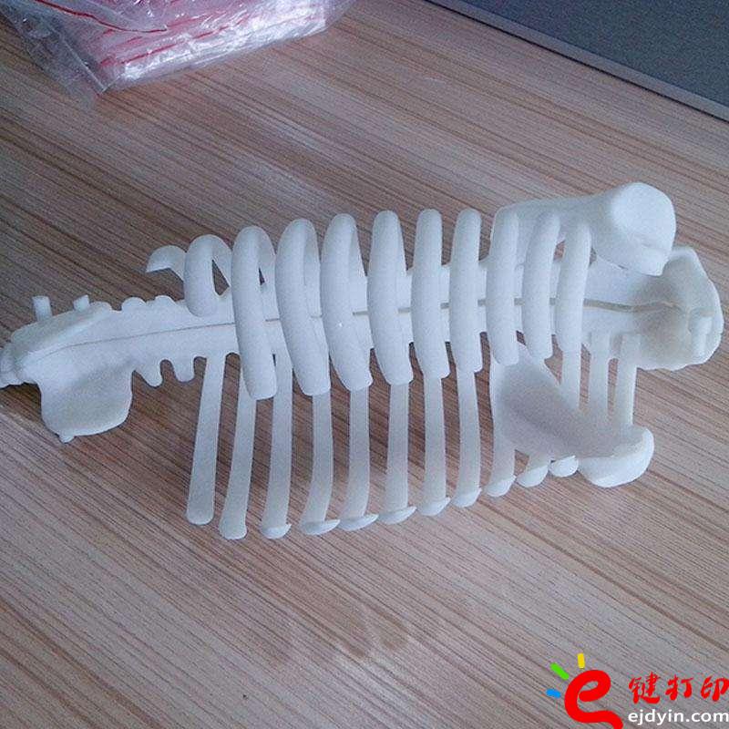 醫療3D打印骨骼模型、3d打印定制手板,3d打印加工手板,3d打印手板模型,3d打印模型,深圳3d打印手板,3d打印手板工廠,工業級3d打印手板公司